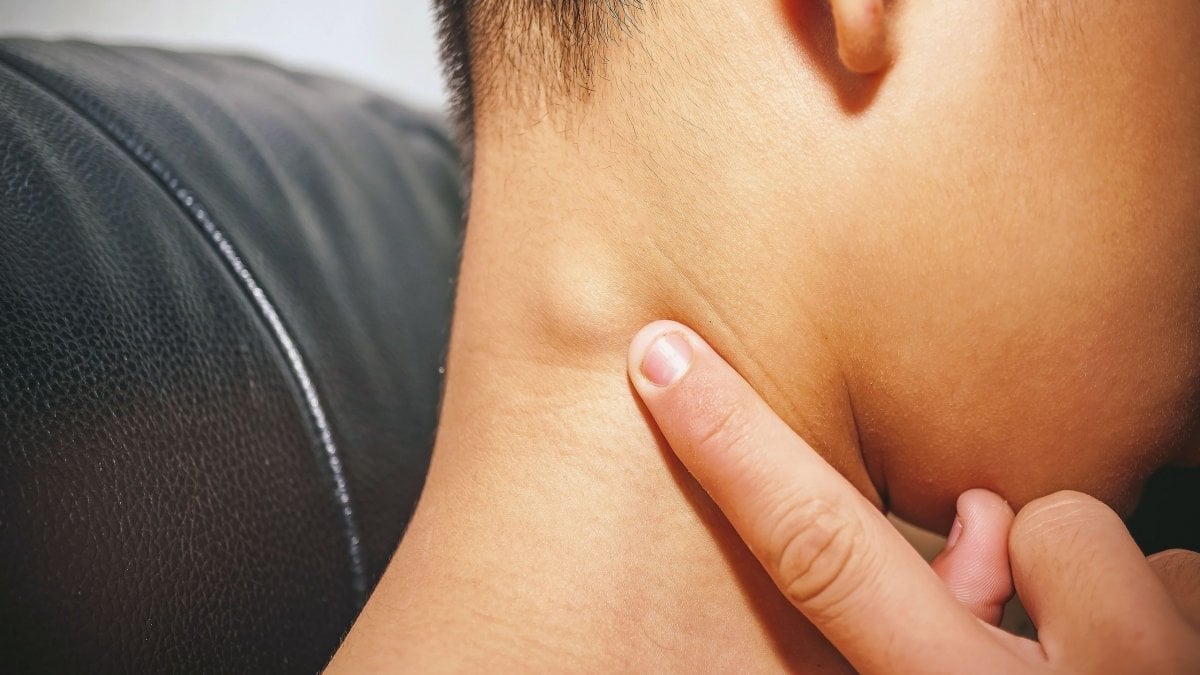 54a84f12 bigstock lymph node inflammation of the 254590171