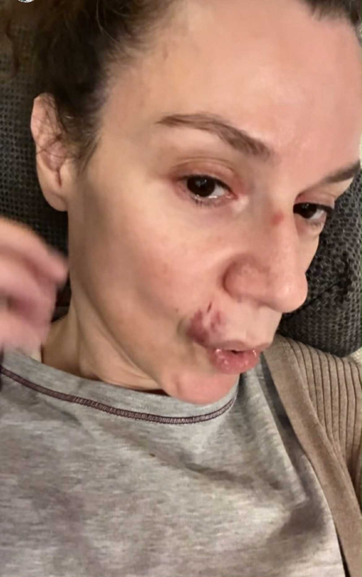 Με μαυρισμένο μάτι και με αίματα στο πρόσωπο η Πέγκυ Τρικαλιώτη 4 peggi