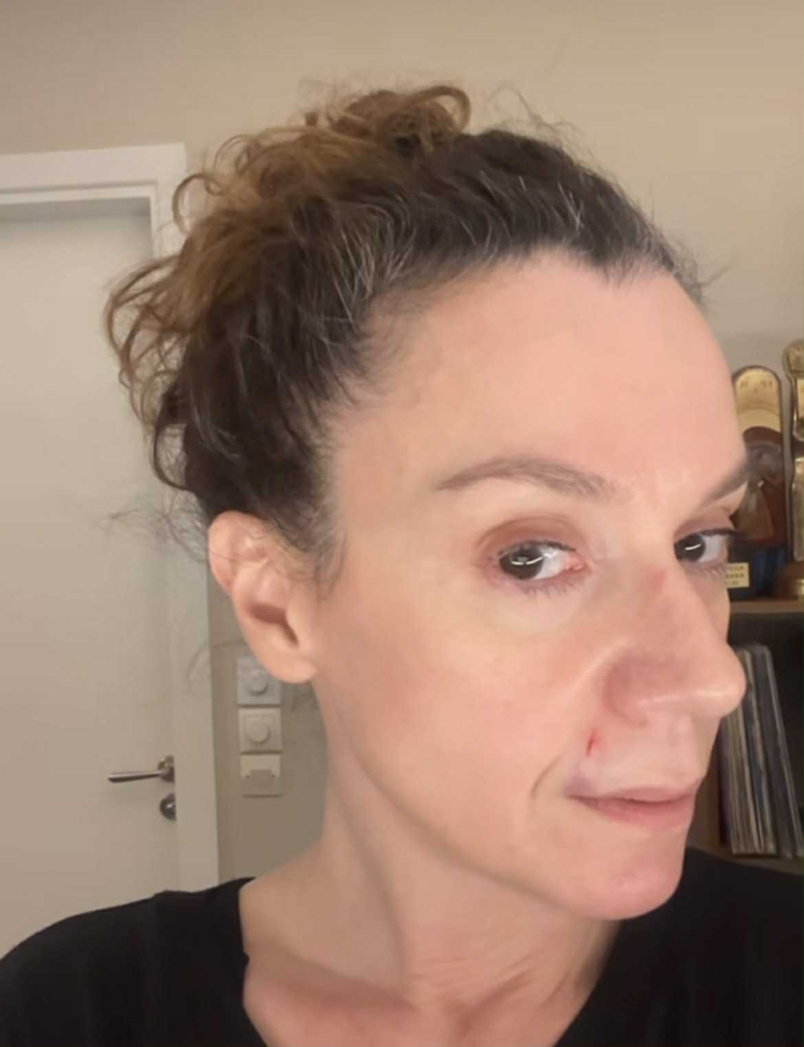 Με μαυρισμένο μάτι και με αίματα στο πρόσωπο η Πέγκυ Τρικαλιώτη 3 pegi