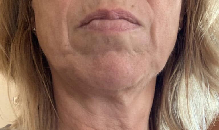 Ενδοκρινολόγος αποκαλύπτει τα δύο φαγητά που κάνουν το δέρμα να γερνά πιο γρήγορα