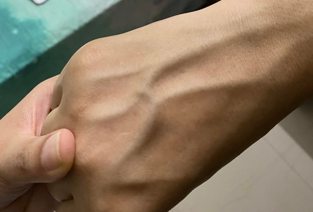 stigmiotypo othonis 2025 11 11 03.07.47