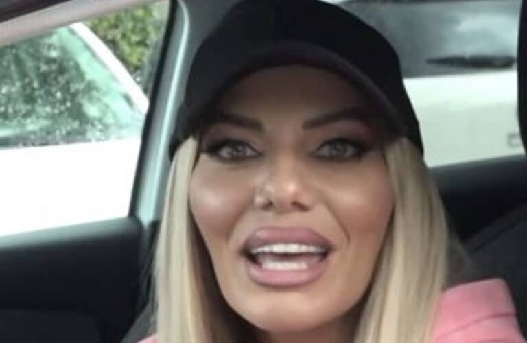 Αγνώριστη πασίγνωστη Ελληνίδα –  Έγινε άλλος… άνθρωπος από τις επεμβάσεις