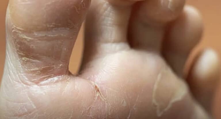 7 συμπτώματα που μπορεί να υποδηλώνουν σοβαρά προβλήματα υγείας