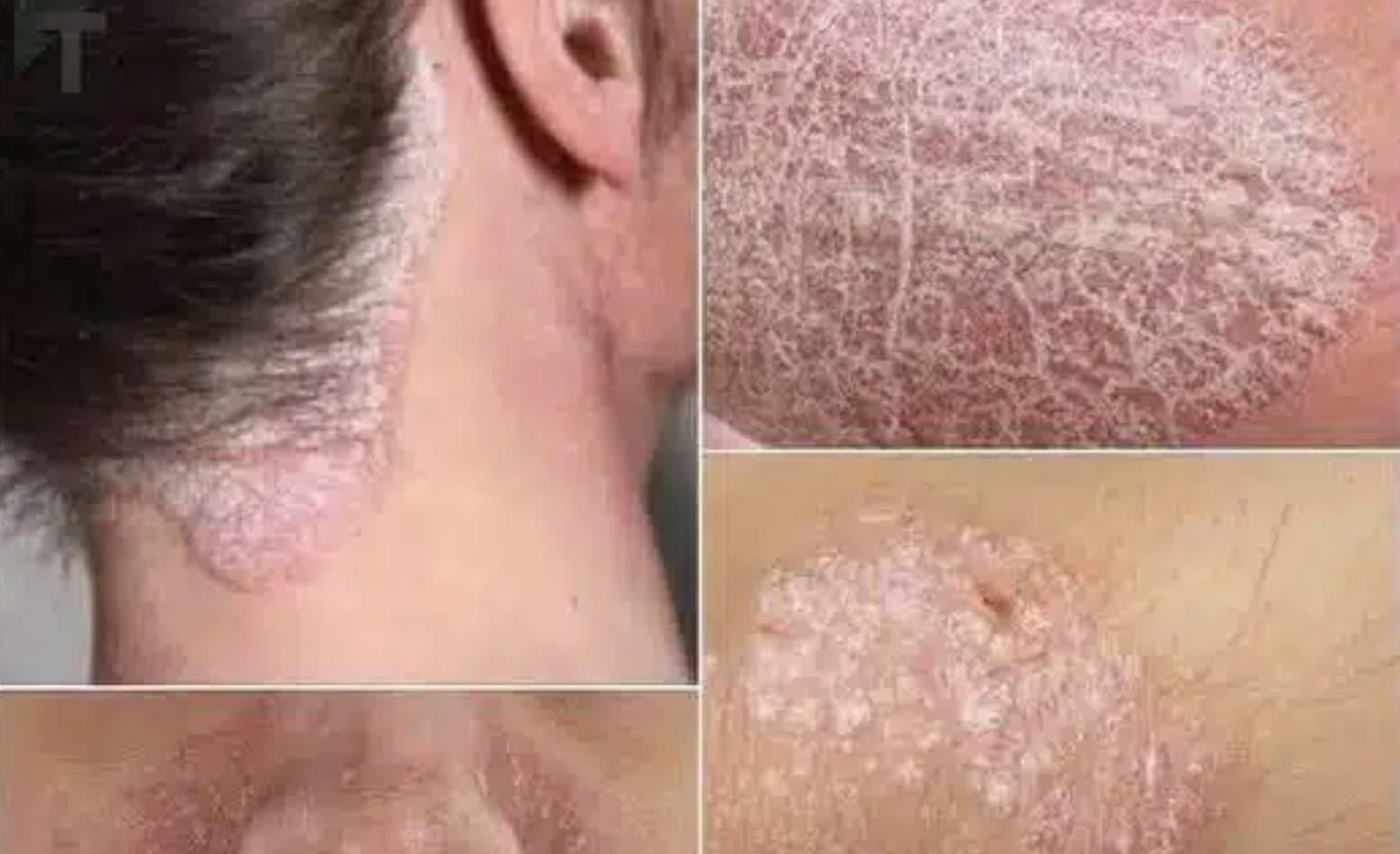 stigmiotypo othonis 2025 11 23 21.57.01