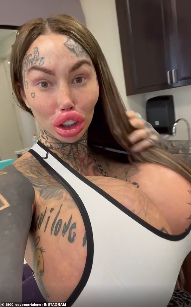 104664433 15373447 at one point gongora was unable to close her mouth properly afte a 39 1765555146725