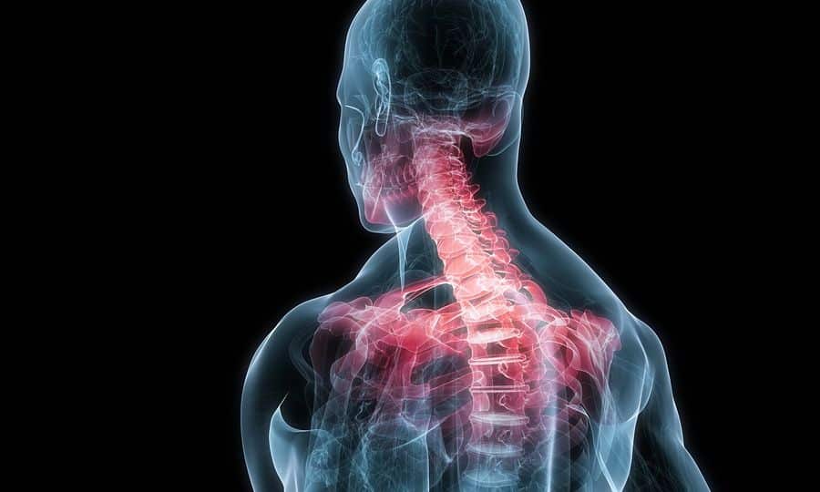 bigstock inflamed neck 6989507