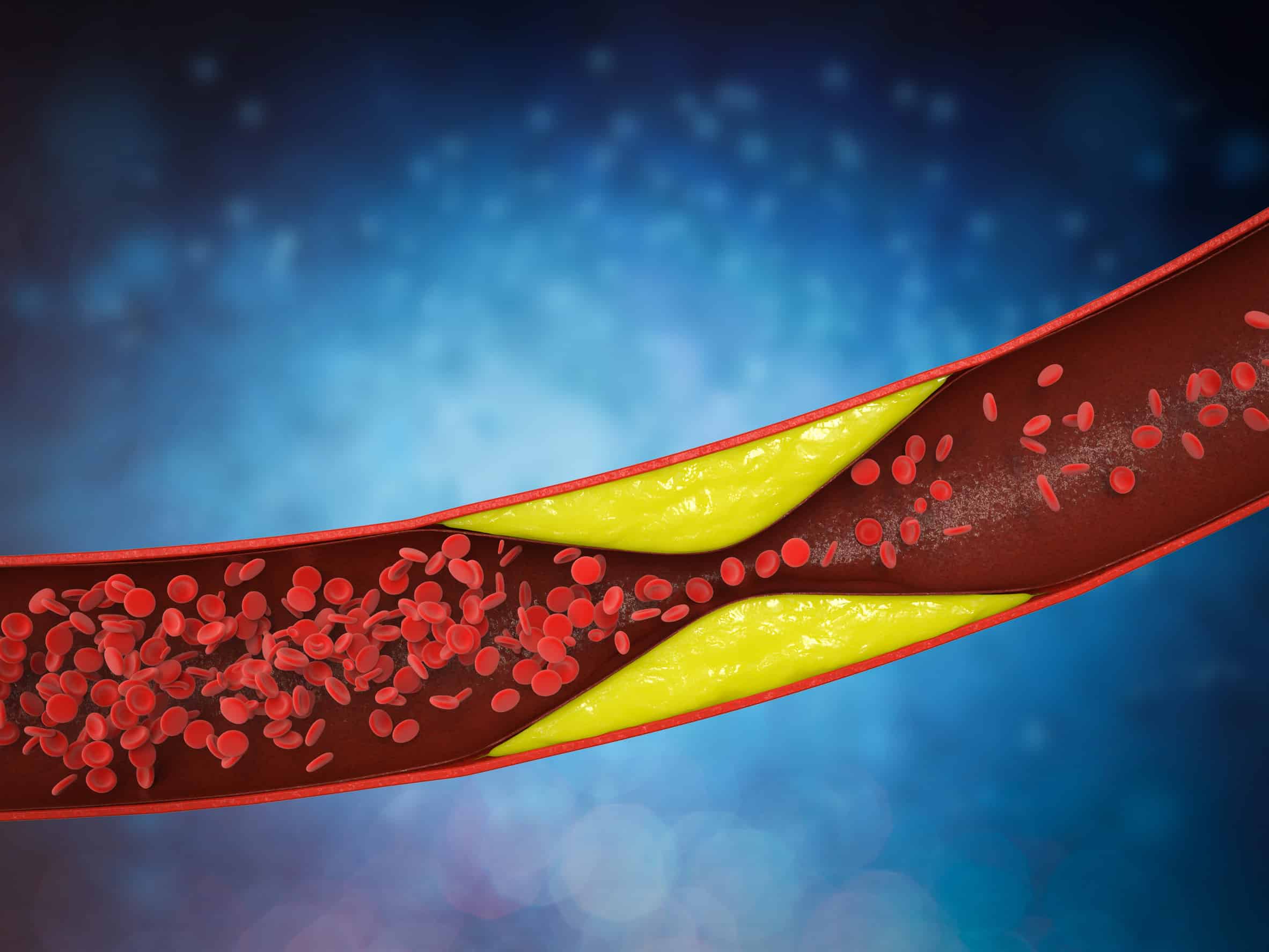 fragmenes artiries symptomata antimetopisi