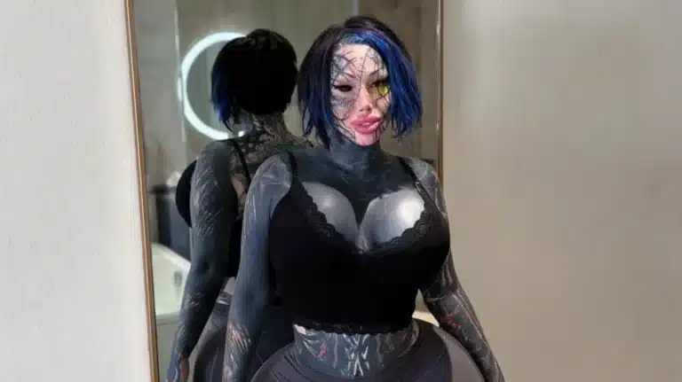 Εθισμένη στις πλαστικές επεμβάσεις 33χρονη έπεσε από τον 9ο όροφο ξενοδοχείου – Η μυστηριώδης τελευταία ανάρτησή της