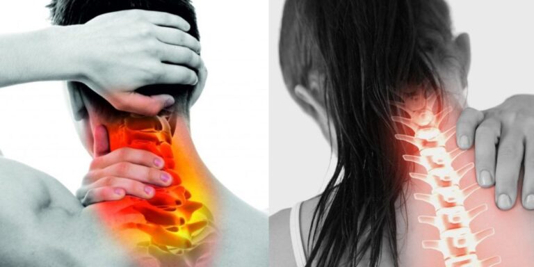 Πόνος στον αυχένα: 2 γιατροσόφια το μυστικό για άμεση ανακούφιση