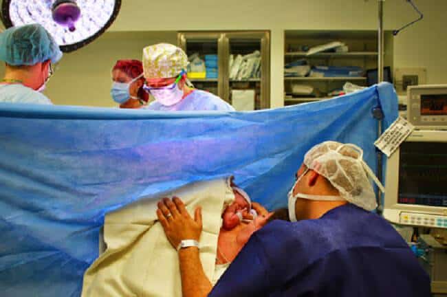 skin to skin csection 2