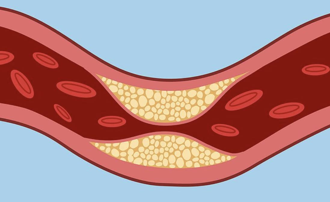 stigmiotypo othonis 2025 12 06 17.36.29