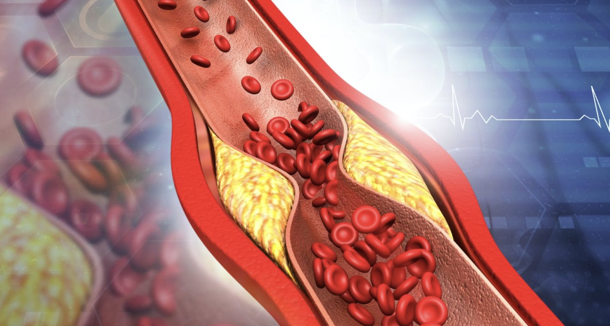 stigmiotypo othonis 2025 12 06 23.42.14