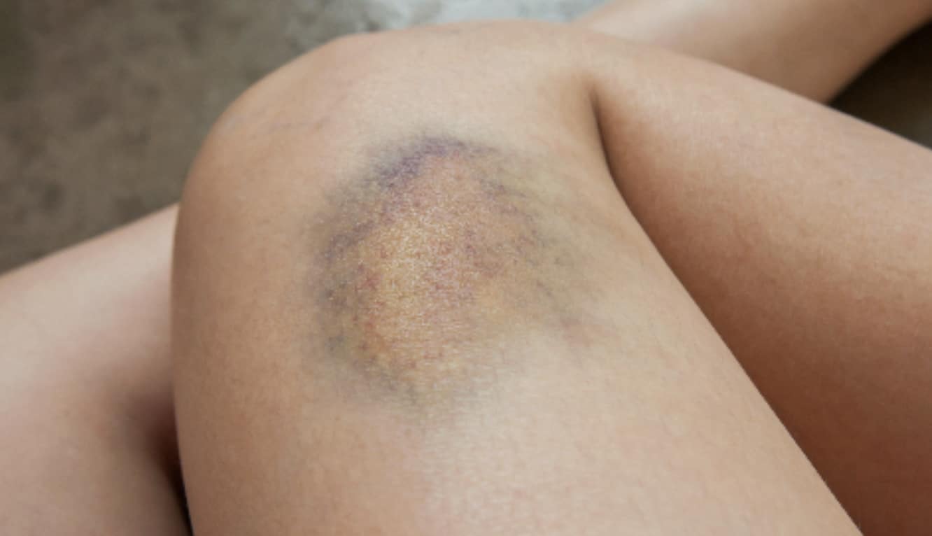 stigmiotypo othonis 2025 12 10 00.24.10