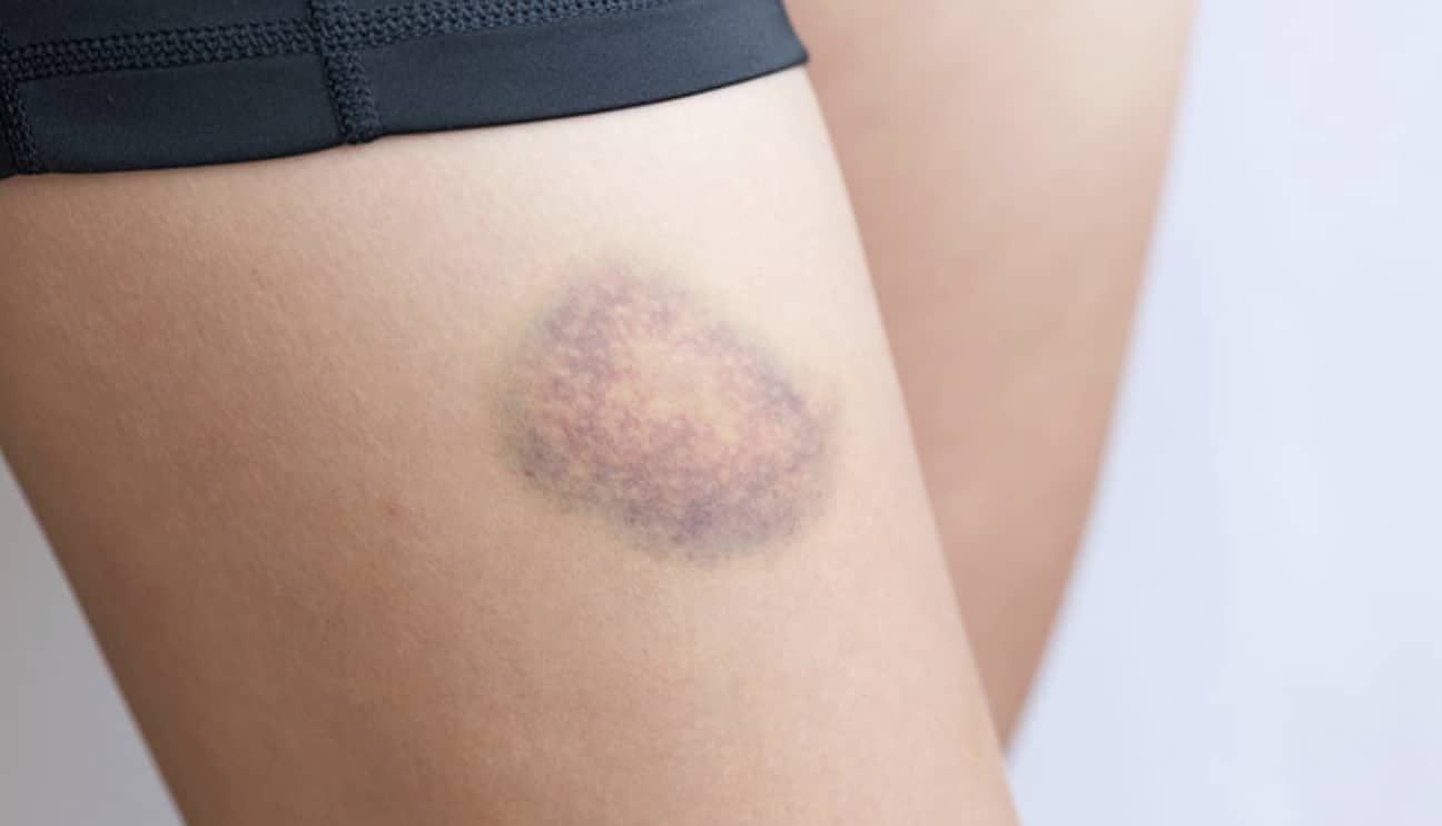 stigmiotypo othonis 2025 12 10 00.24.27