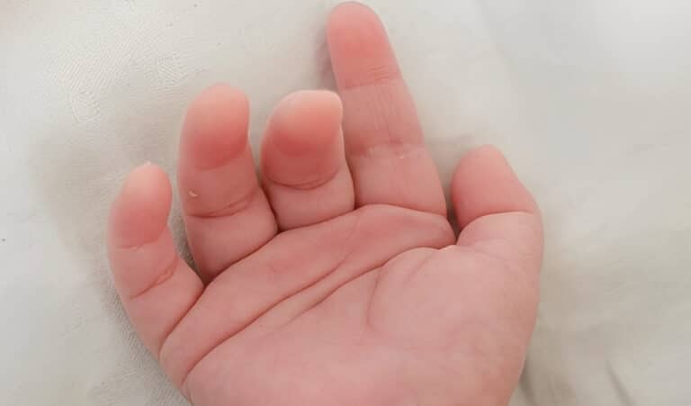 197 παιδιά γεννήθηκαν από σπέρμα δότη με καρκινικό γονίδιο – Χρησιμοποιήθηκε και στην Ελλάδα