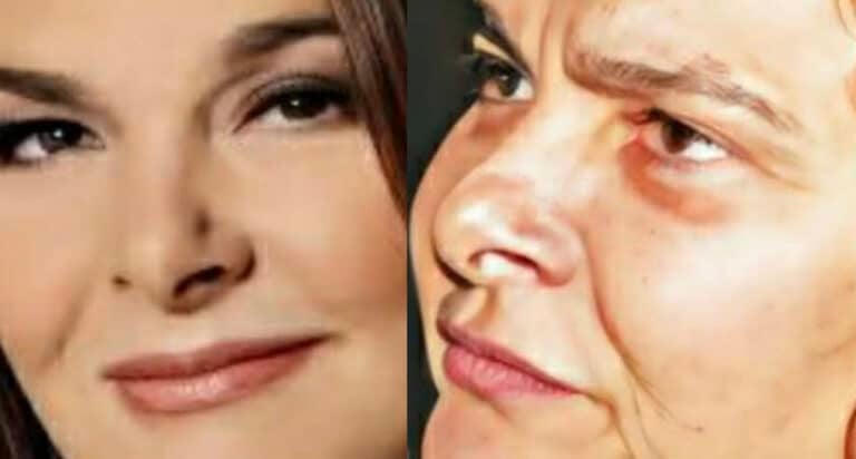 Αγνώριστη σήμερα στα 65 η πασίγνωστη τραγουδίστρια μεγάλων επιτυχιών