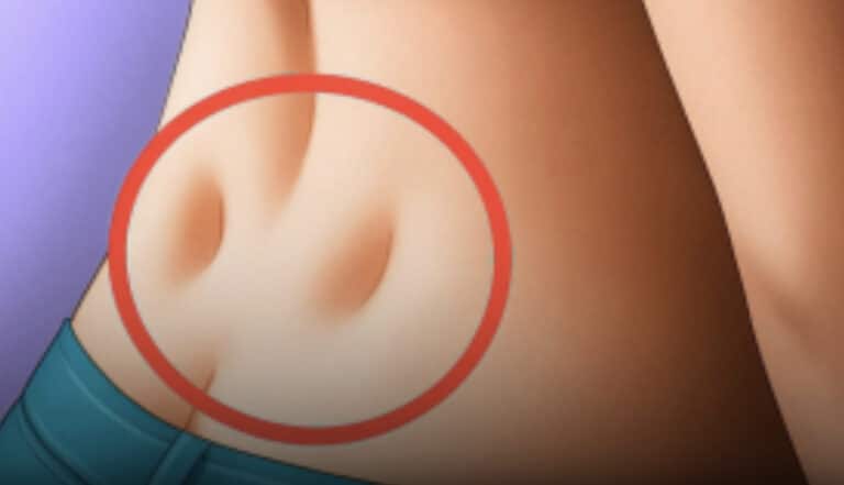 Έχετε αυτά τα δύο μικρά λακκάκια στη βάση της πλάτης σας; Τι αποκαλύπτουν
