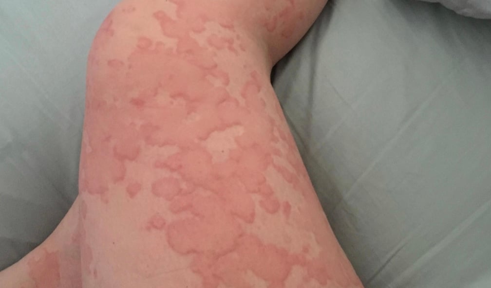 stigmiotypo othonis 2026 01 03 02.11.36