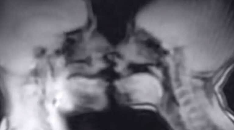 Έκαναν σeξ μέσα σε μαγνητικό τομογράφο και κατέληξαν σε επιστημονική ανακάλυψη!