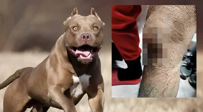 Σοκ στην Ομόνοια με πίτμπουλ – «Το σκυλί με δάγκωνε και αυτός με χτυπούσε»