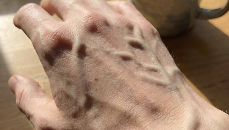 Ο χάρτης της ανθρώπινης κυκλοφορίας και οι βιολογικοί παράγοντες που διαμορφώνουν την ορατότητα του αγγειακού δικτύου