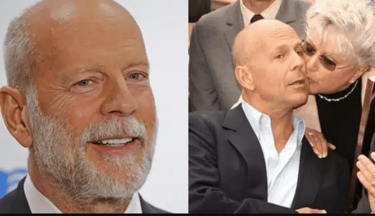 Παγκόσμια θλίψη για τον Μπρους Γουίλις – Δεν μπορεί να αναγνωρίσει τους γύρω του – Θα δωρίσουν τον εγκέφαλο του στην επιστήμη, μετά τον θάνατό του