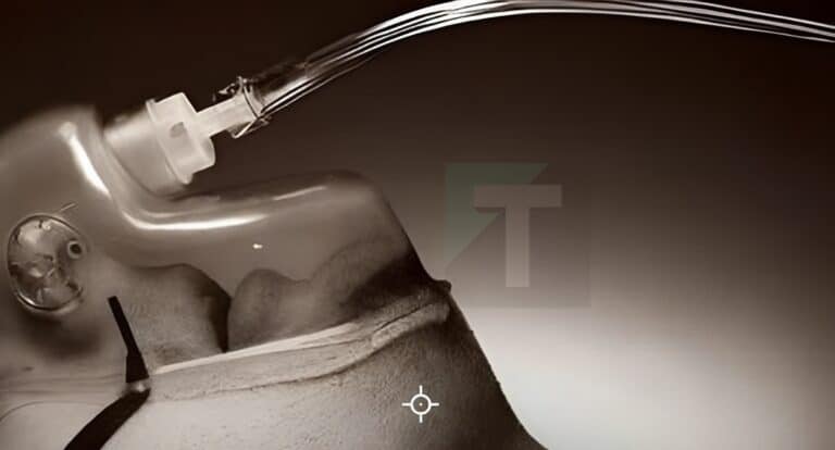 Η οσμή που αντιλαμβάνονται ορισμένοι άνθρωποι πριν από τον θάνατο: Tι λέει η επιστήμη και γιατί συμβαίνει