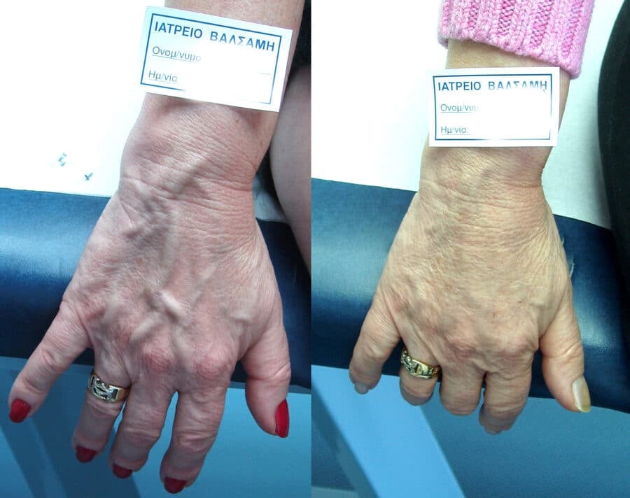 rafail 2 prin meta e1642982026172