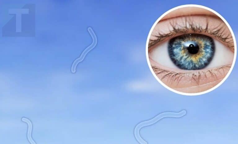 Οφθαλμίατρος αποκαλύπτει τι να κάνετε αν αρχίσετε να βλέπετε «μυγάκια»