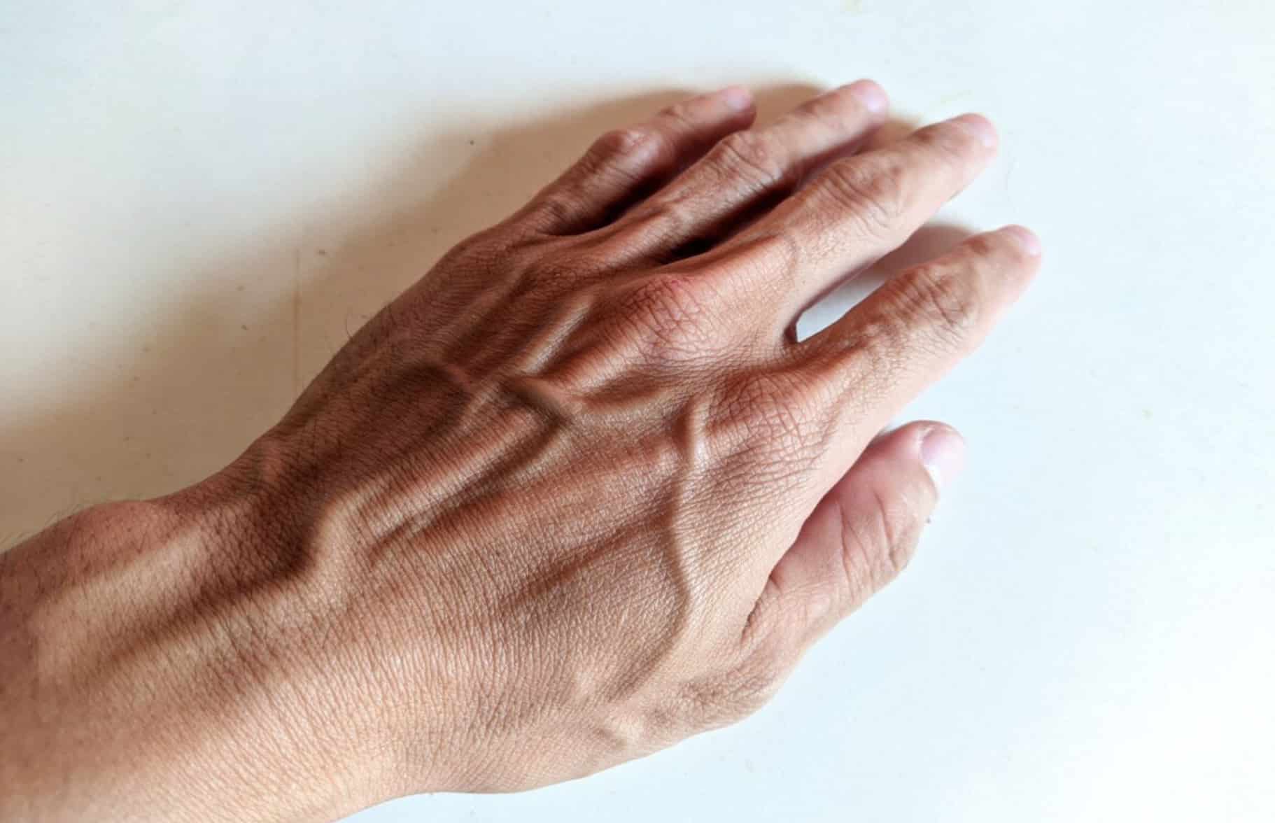 stigmiotypo othonis 2026 02 21 18.01.05