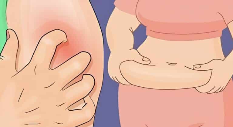 Σάκχαρο: 14 προειδοποιητικά σημάδια ότι μπορεί να έχει αυξηθεί και δεν πρέπει να αγνοήσετε