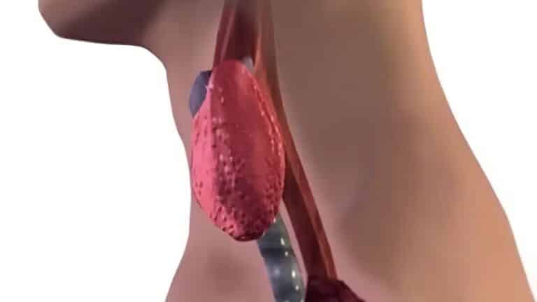 Σταματήστε να τρώτε αμέσως αυτά τα 6 τρόφιμα που χειροτερεύουν τον θυρεοειδή