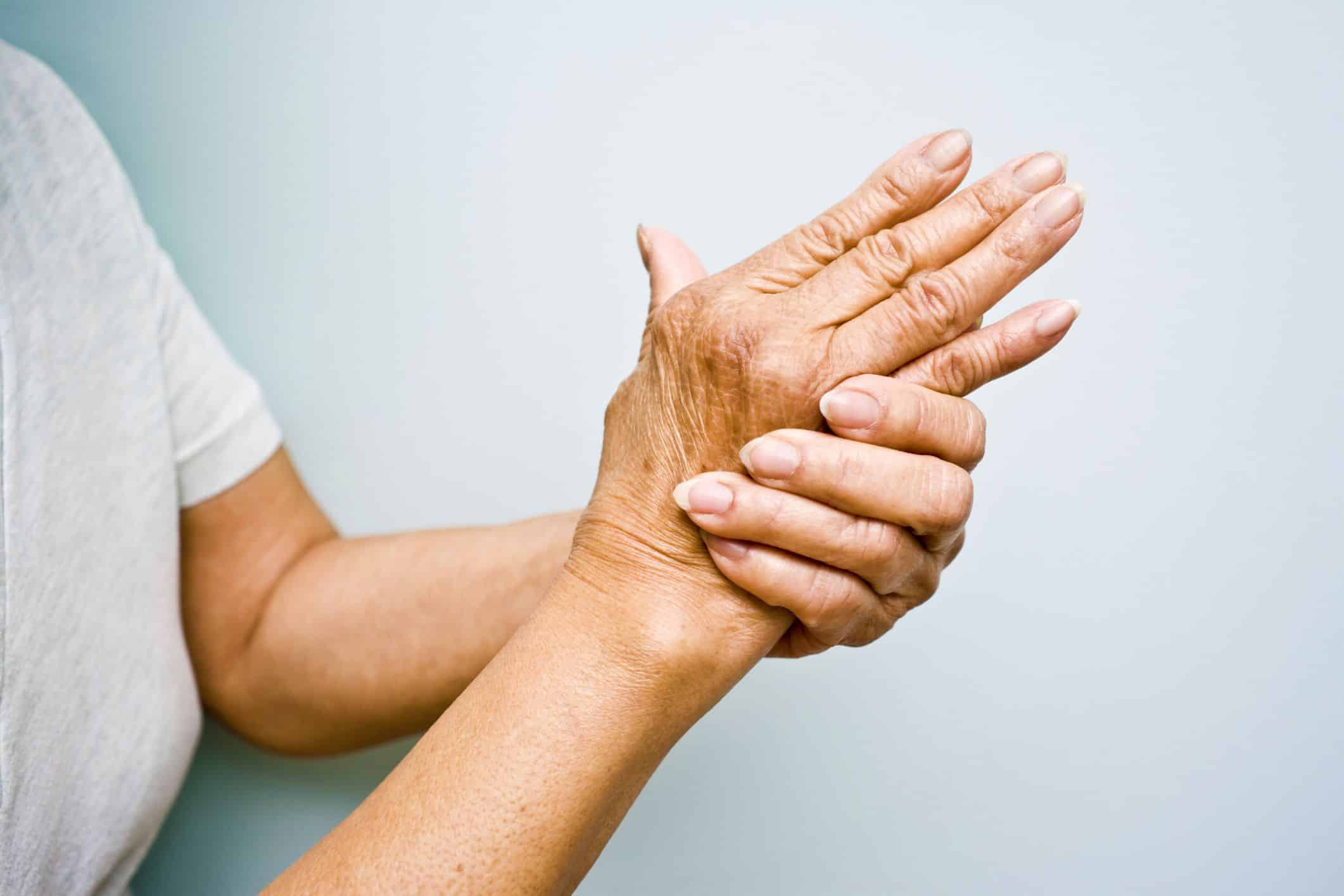 25924026 hands rheumatoid arthritis