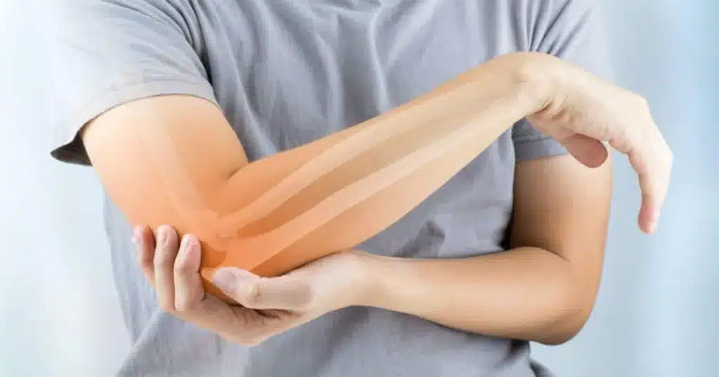 pos voithaei i askisi stin reymatoeidi arthritida