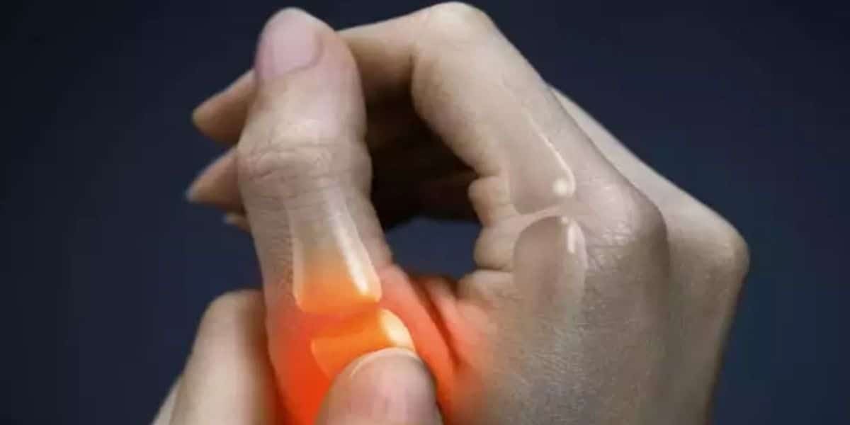 ti na epilegete proino geyma na min epideinonetai arthritida