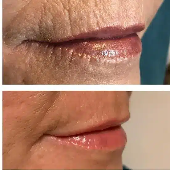 499196 b2ecfd45d2d546ad8113121231801eddmv2