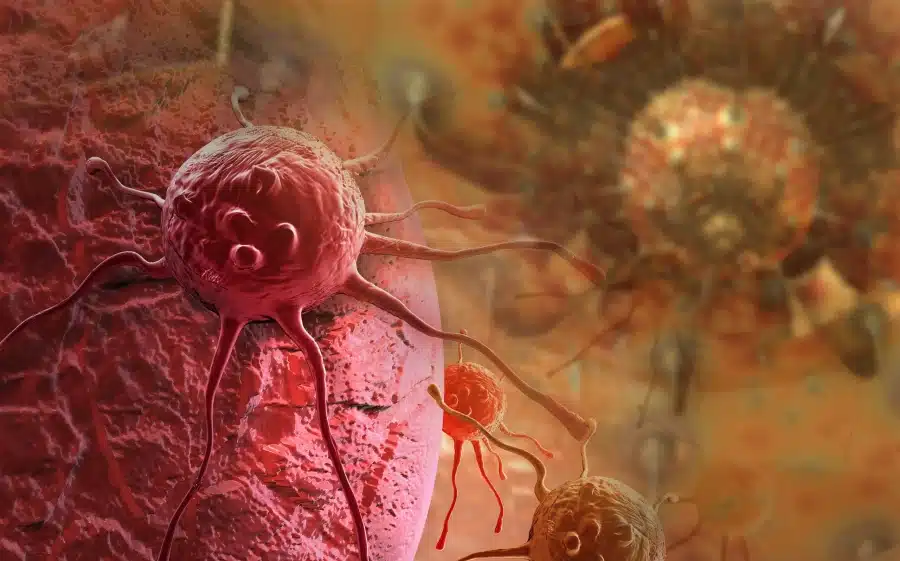 bigstock cancer cell 129640574