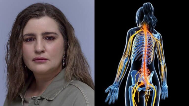 Τι είναι το αυτοάνοσο «ινομυαλγία» που έχει η Μαρία Κίτσου;