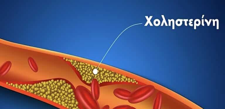 Χοληστερίνη: 2 φυσικές τροφές που τη μειώνουν αποτελεσματικά – Δρουν σαν τις στατίνες