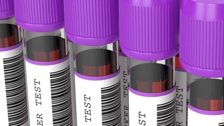 Πότε η γενική αίματoς δείχνει καρκίνο