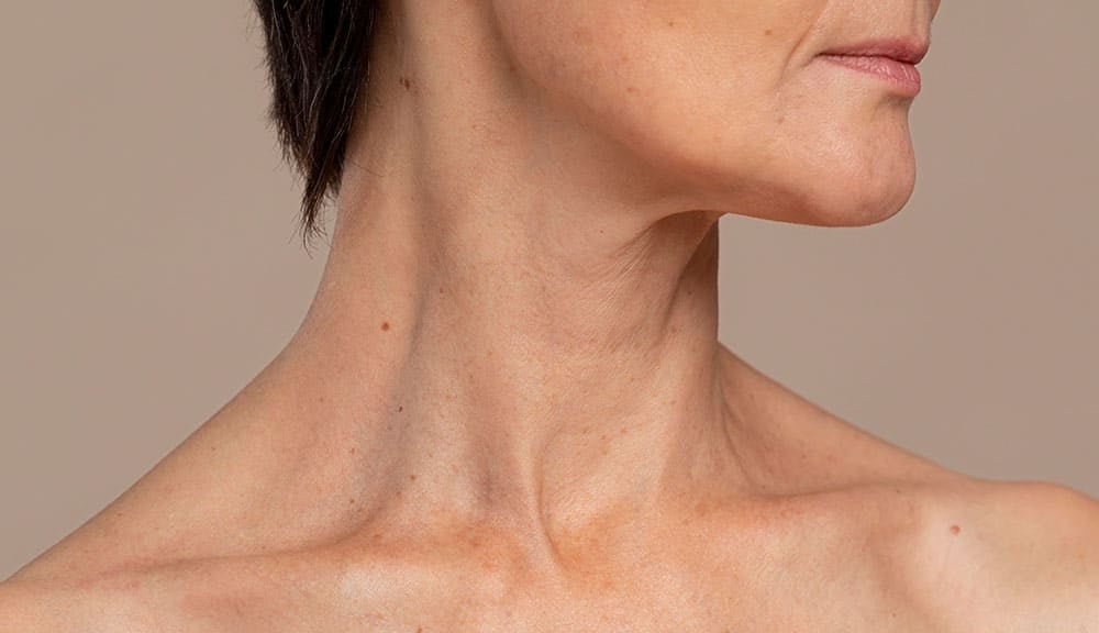 best drooping jowls and sagging neck treatment in cincinnati ohio
