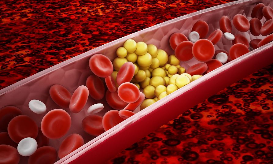 bigstock fat cells blocking the blood f 290089546