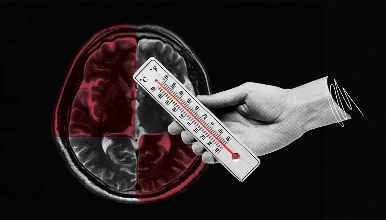 10308 feature2 brain widescreen