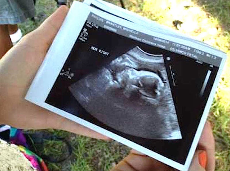 sonogram1 copy1