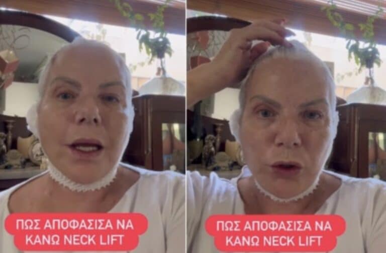 Νανά Παλαιτσάκη: Το ιατρικό ζήτημα που την οδήγησε στο χειρουργείο, το λίφτινγκ λαιμού και το ηχηρό μήνυμα προς όλες τις γυναίκες