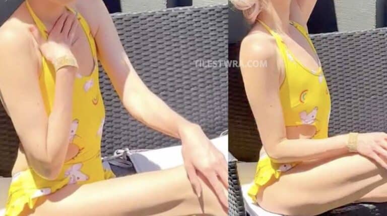 Ανησυχία για πασίγνωστη καλλονή Ελληνίδα – Η νέα εμφάνιση που ανησύχησε