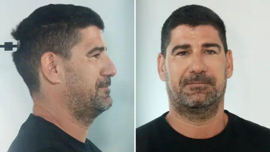 Για βιασμούς ανήλικων αθλητριών κατά εξακολούθηση διώκεται Έλληνας προπονητής 2 xrwma astinomiko