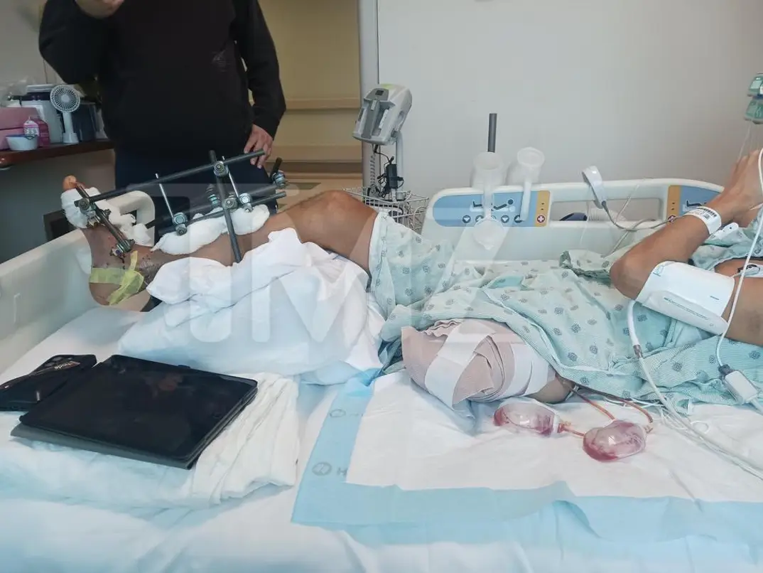 Ο Σταύρος Φλώρος ζητάει πάνω από 100 εκατ. δολάρια μετά τον ακρωτηριασμό του ποδιού του 4 e5c0c69bd6a04ade8b194da03ed4f2dc lg