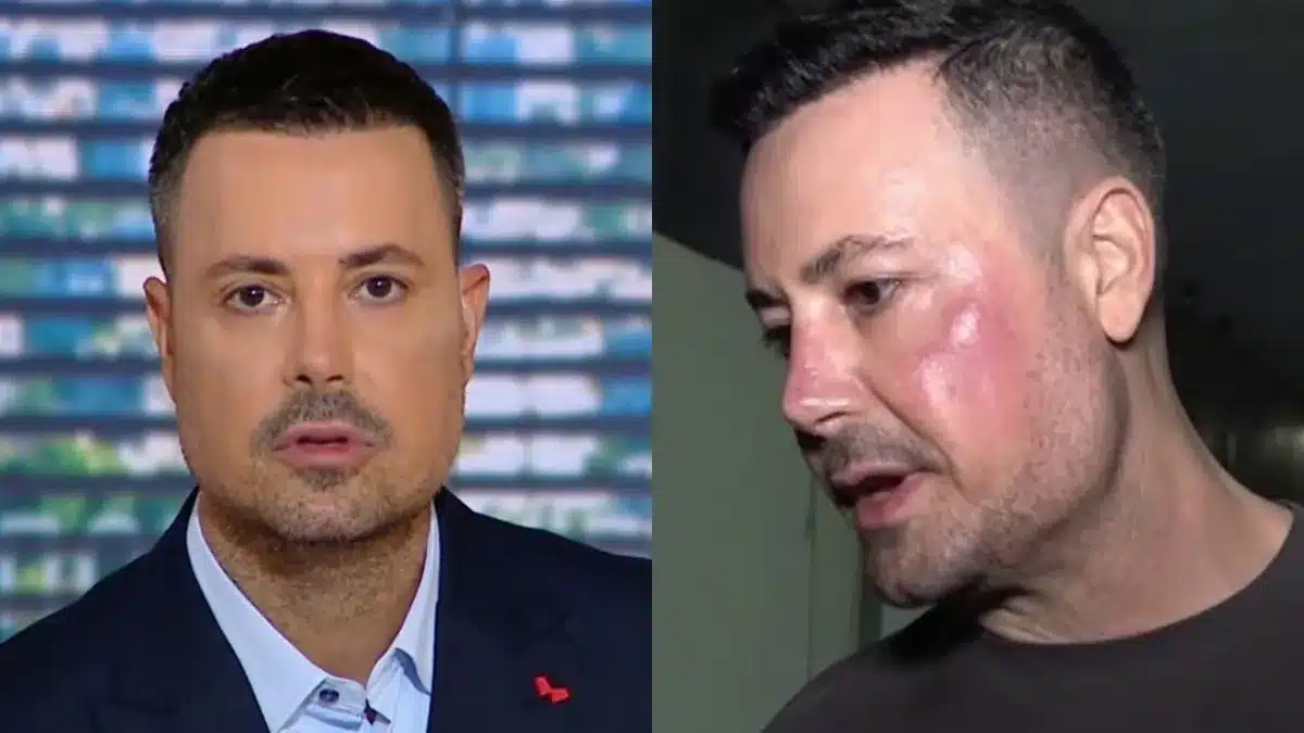 «Τι έκανα εγώ και τρέλανα τα κύτταρά μου;»: 14 επώνυμοι Έλληνες που ταλαιπωρούνται από αυτοάνοσα νοσήματα 6 kousoulos 4